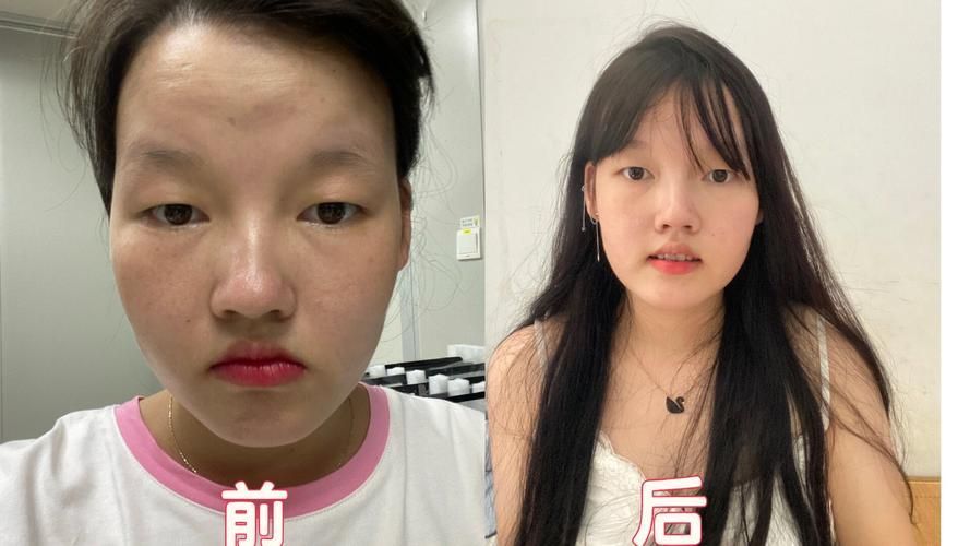 哪種方法矯正龍魚口合不攏最有效？（arxiv論文助手（arxiv論文助手）哪種方法矯正最有效）
