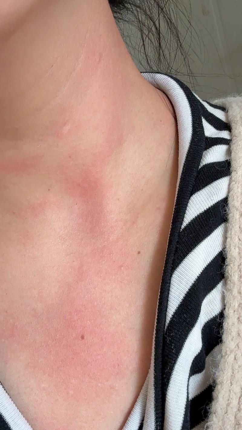 如何判斷自己是否對鱘龍魚過敏？（———醫學診斷鱘龍魚過敏診斷流程詳解）