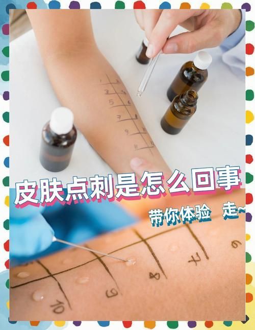 如何判斷自己是否對鱘龍魚過敏？（———醫學診斷鱘龍魚過敏診斷流程詳解）