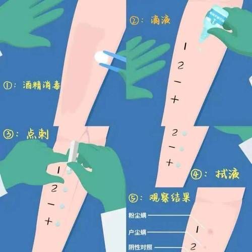 如何判斷自己是否對鱘龍魚過敏？（———醫學診斷鱘龍魚過敏診斷流程詳解）