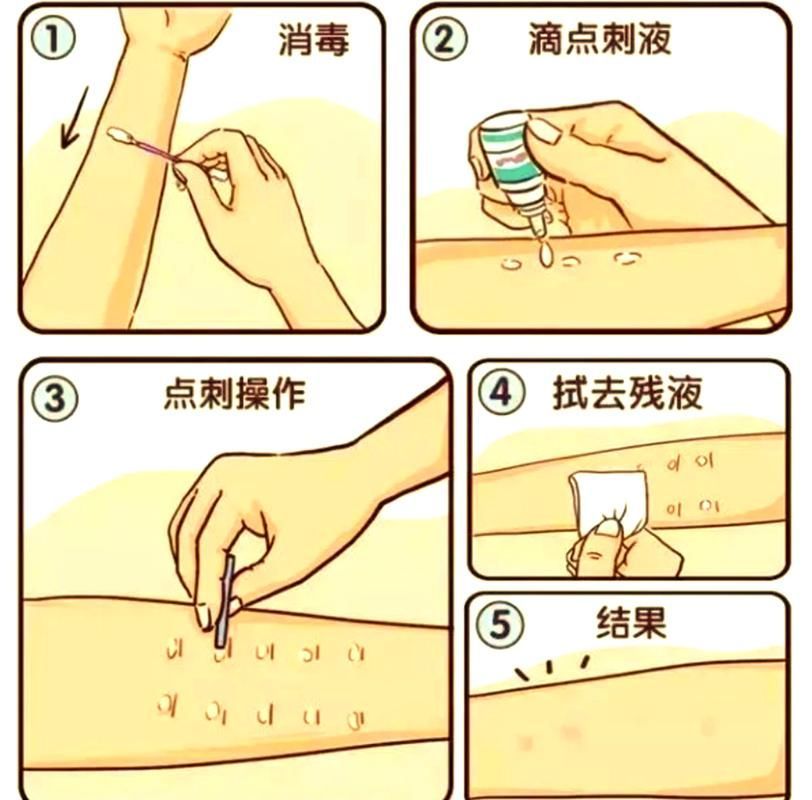 如何判斷自己是否對鱘龍魚過敏？（———醫學診斷鱘龍魚過敏診斷流程詳解）