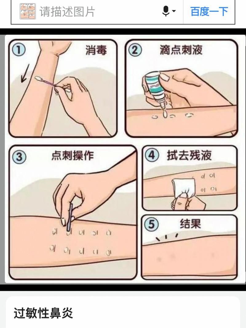 如何判斷自己是否對鱘龍魚過敏？（———醫學診斷鱘龍魚過敏診斷流程詳解）