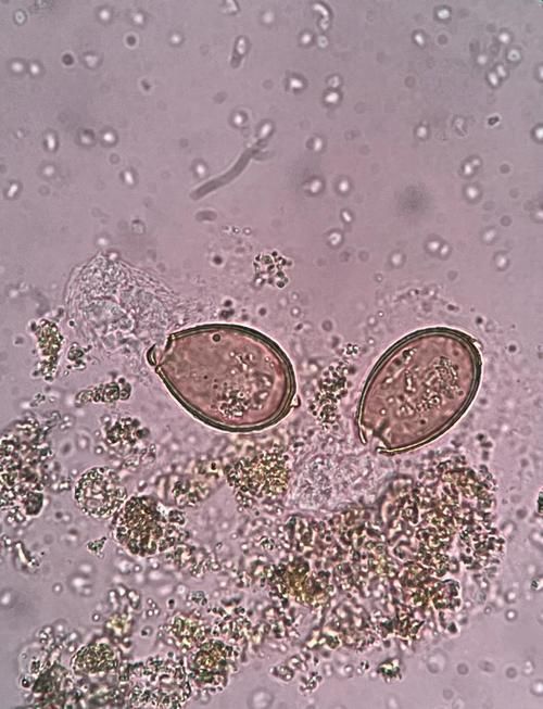 生肉喂食對龍魚有哪些潛在風險？（生肉喂食對生肉喂食對龍魚的多重潛在風險信息整理完成）