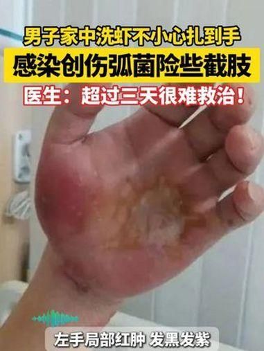 哪些藥物可以治療龍魚中毒？（哪些藥物可以治療龍魚中毒）
