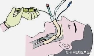 如何正確使用龍魚鎮定劑？（如何正確使用龍魚鎮定劑） 如何正確使用龍魚鎮定劑？（如何正確使用龍魚鎮定劑） 龍魚百科 第4張