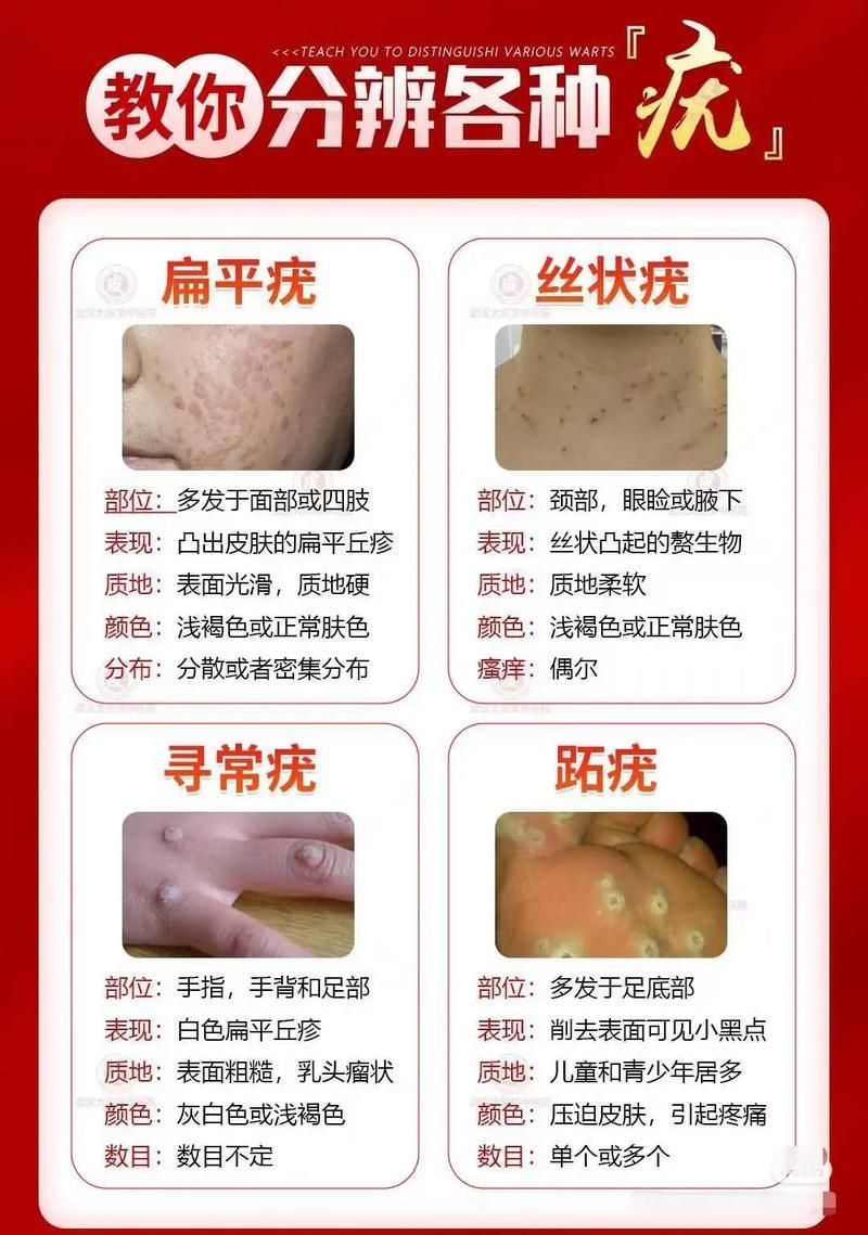 給我一張龍魚肉粒與疣的對比圖（如何區(qū)分龍魚肉粒與疣？）