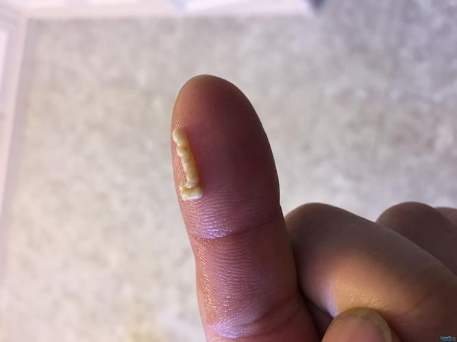 如何判斷龍魚腸炎是否好轉或惡化？（如何判斷龍魚腸炎）