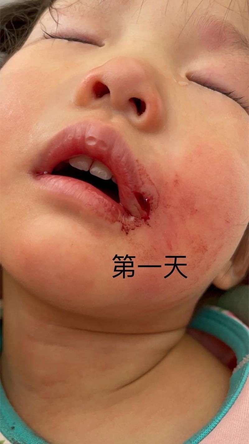 如何判斷龍魚嘴撞豁是否嚴重？（——權威分級標準與實操判斷龍魚嘴撞豁嚴重程度）