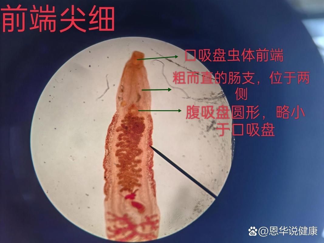 哪些常見的魚寄生蟲對人體有害（中國衛(wèi)健委與國家食品安全風(fēng)險(xiǎn)評估中心魚寄生蟲詳解）