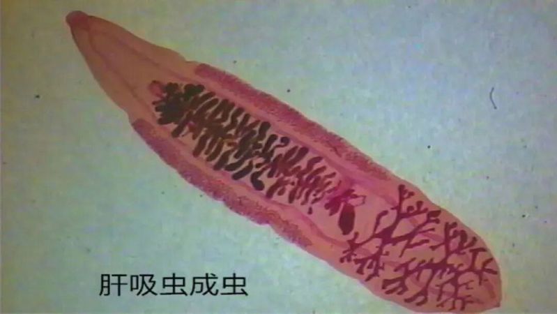 哪些常見的魚寄生蟲對人體有害（中國衛(wèi)健委與國家食品安全風(fēng)險(xiǎn)評估中心魚寄生蟲詳解）