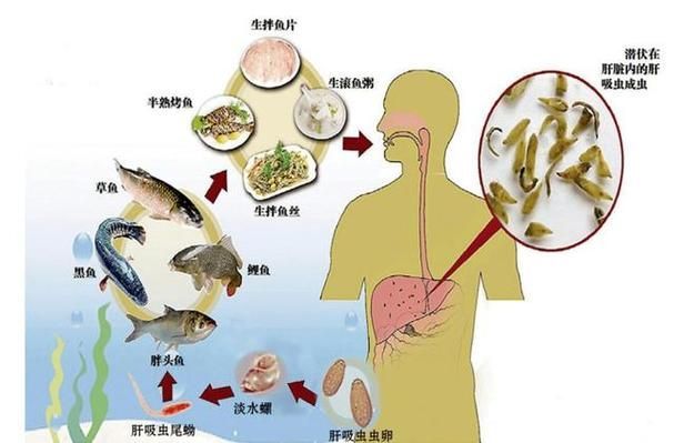 哪些常見的魚寄生蟲對人體有害（中國衛(wèi)健委與國家食品安全風(fēng)險(xiǎn)評估中心魚寄生蟲詳解）