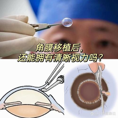 重度蒙眼病如何治療（西安地區治療重度蒙眼病治療重度蒙眼病的治療方案） 重度蒙眼病如何治療（西安地區治療重度蒙眼病治療重度蒙眼病的治療方案） 龍魚百科 第5張