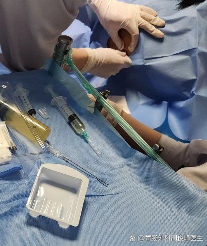 腹腔穿刺放液術風險大嗎（腹腔穿刺放液術的風險可控并非無害——）