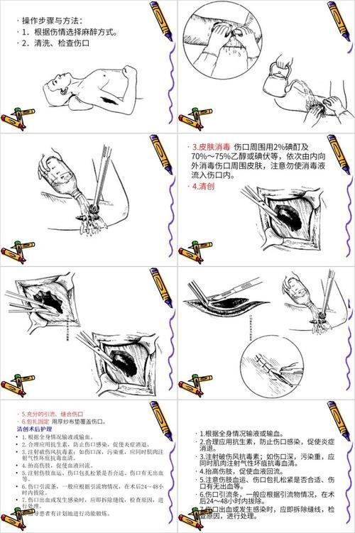 清創手術的風險有多大（清創手術后感染、感染、出血、出血、疼痛低、疼痛低）