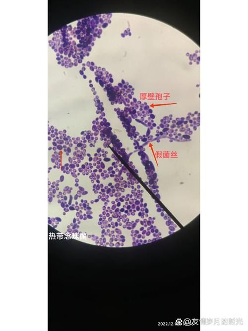 能否提供農作物真菌和細菌的顯微鏡下圖像（關于農作物真菌和細菌的顯微鏡下圖像的摘要）