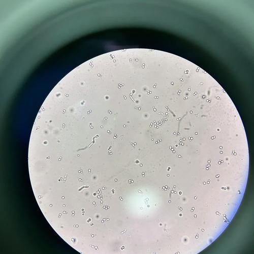 能否提供農作物真菌和細菌的顯微鏡下圖像（關于農作物真菌和細菌的顯微鏡下圖像的摘要）