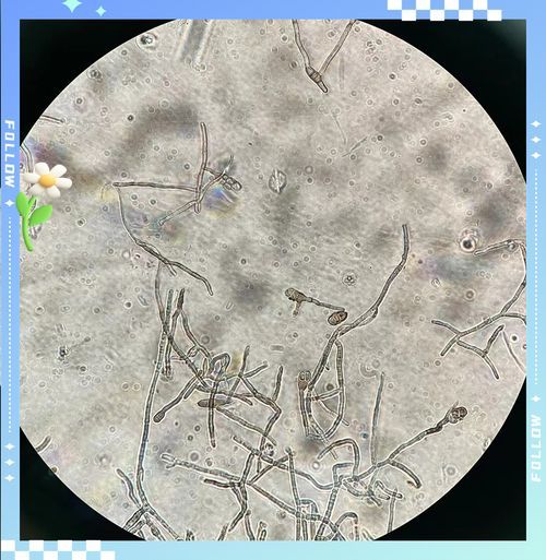 能否提供農作物真菌和細菌的顯微鏡下圖像（關于農作物真菌和細菌的顯微鏡下圖像的摘要）