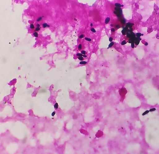 能否提供農作物真菌和細菌的顯微鏡下圖像（關于農作物真菌和細菌的顯微鏡下圖像的摘要）