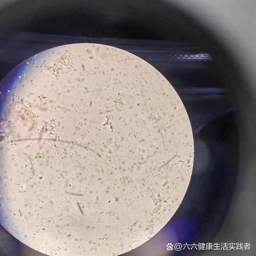 能否提供農作物真菌和細菌的顯微鏡下圖像（關于農作物真菌和細菌的顯微鏡下圖像的摘要）