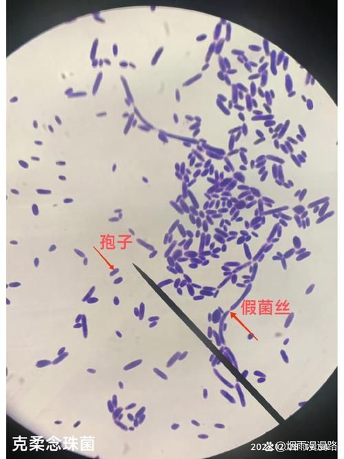 能否提供農作物真菌和細菌的顯微鏡下圖像（關于農作物真菌和細菌的顯微鏡下圖像的摘要）