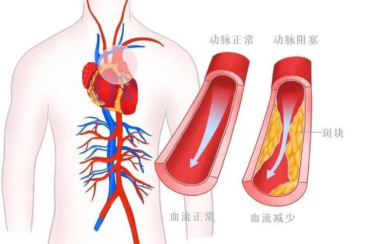 能否提供更詳細(xì)的充血征兆描述（arxiv論文助手arxiv論文助手獲取權(quán)威醫(yī)學(xué)文獻(xiàn)）