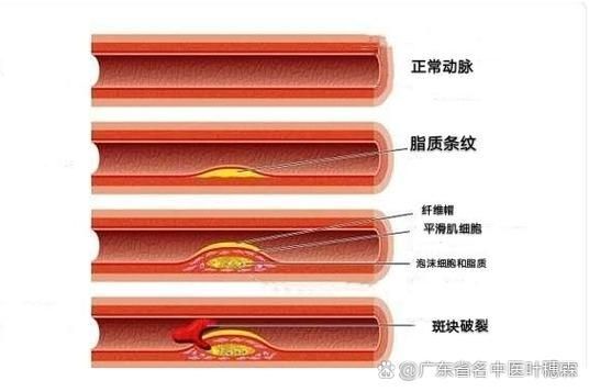 能否提供更詳細(xì)的充血征兆描述（arxiv論文助手arxiv論文助手獲取權(quán)威醫(yī)學(xué)文獻(xiàn)）