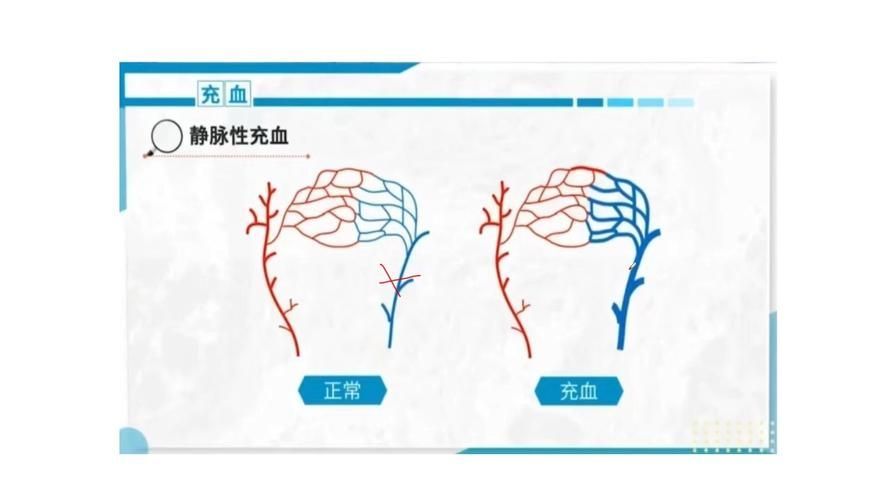 能否提供更詳細(xì)的充血征兆描述（arxiv論文助手arxiv論文助手獲取權(quán)威醫(yī)學(xué)文獻(xiàn)）