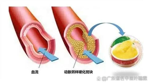 能否提供更詳細(xì)的充血征兆描述（arxiv論文助手arxiv論文助手獲取權(quán)威醫(yī)學(xué)文獻(xiàn)）