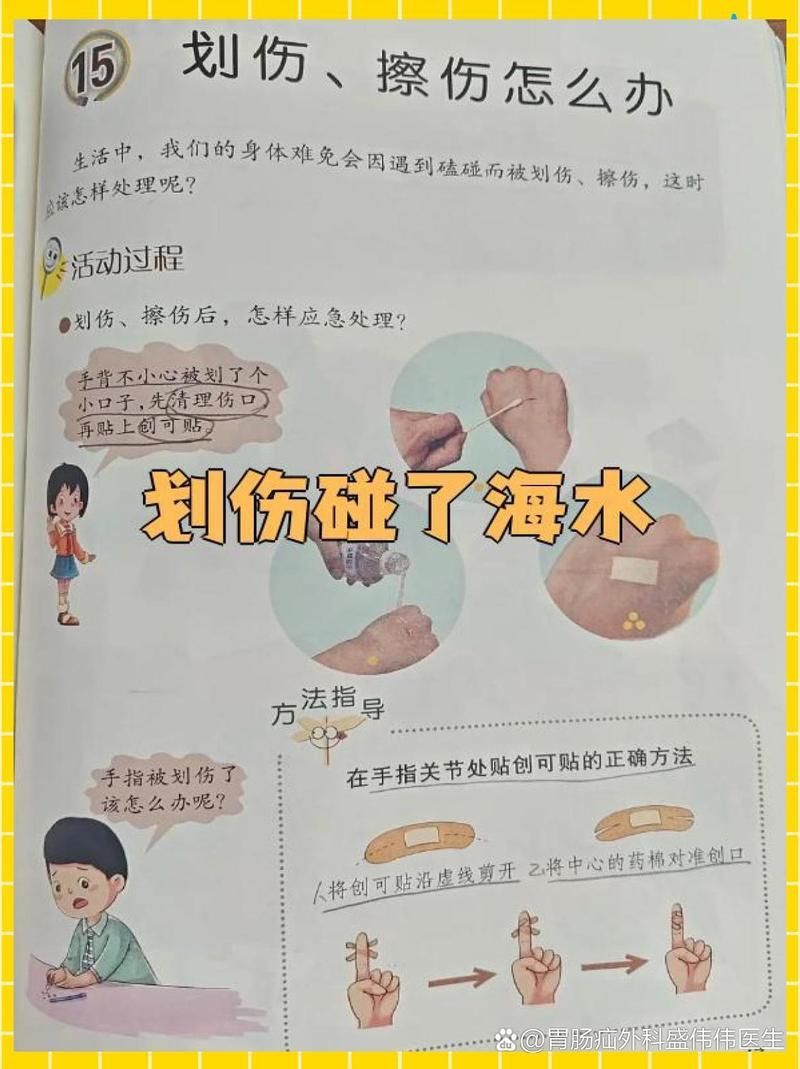 海水細菌感染能自愈嗎，如何預防海水細菌感染