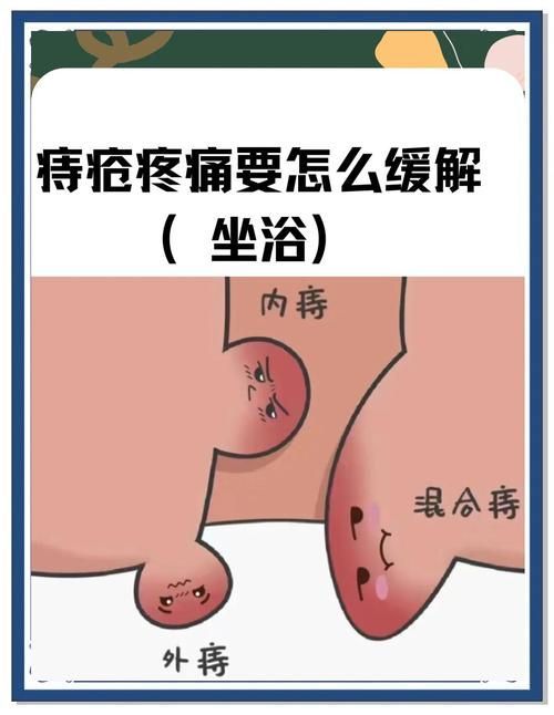 給我一份更詳細(xì)的魚尾充血治療步驟，痔瘡治療流程