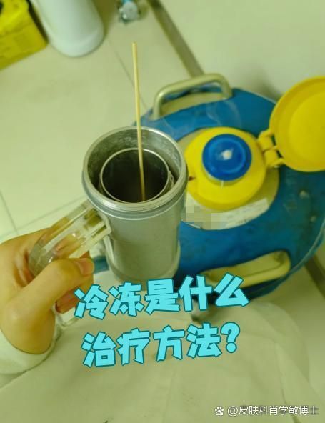 有哪些疾病可以用二氧化碳冷凍技術(shù)治療，二氧化碳冷凍技術(shù)有哪些二氧化碳冷凍治療費(fèi)用大概是多少