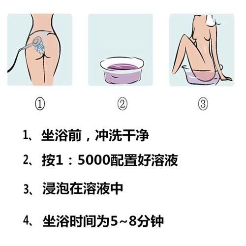 殺魚虱最簡單三個方法，殺魚虱最簡單三個方法詳解魚虱最簡單三個方法詳解