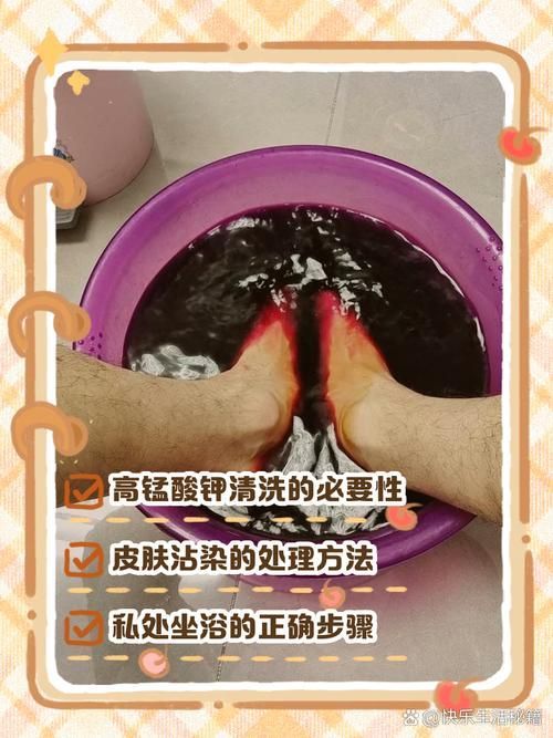 殺魚虱最簡單三個方法，殺魚虱最簡單三個方法詳解魚虱最簡單三個方法詳解