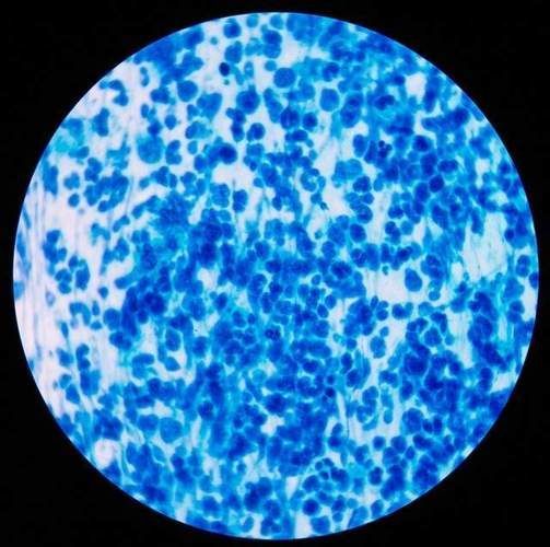 黃粉和甲基藍的用量如何控制，何和甲基藍（甲基藍（甲基藍（methyleneblue）
