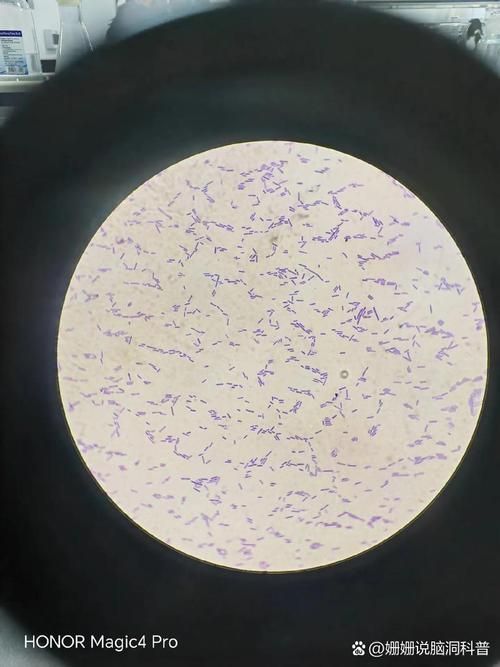 黃粉和甲基藍的用量如何控制，何和甲基藍（甲基藍（甲基藍（methyleneblue）