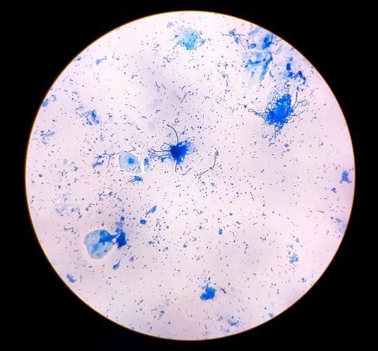 黃粉和甲基藍的用量如何控制，何和甲基藍（甲基藍（甲基藍（methyleneblue）