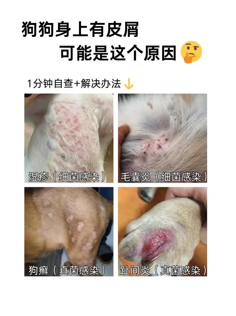 能否提供真菌和細菌感染的對比圖，如何區別真菌和細菌感染