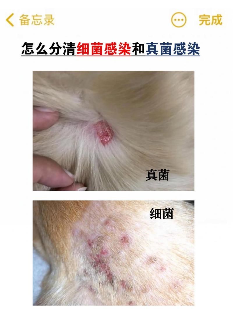能否提供真菌和細菌感染的對比圖，如何區別真菌和細菌感染