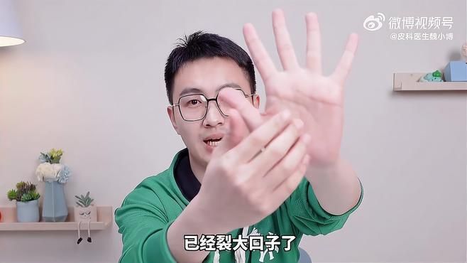 有哪些手部真菌感染的治療方法，手部真菌感染怎么辦 有哪些手部真菌感染的治療方法，手部真菌感染怎么辦 龍魚百科