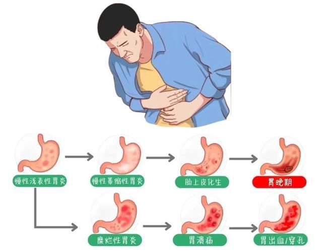 能再詳細分析幾個拒食原因嗎，厭深入探討拒食現象 能再詳細分析幾個拒食原因嗎，厭深入探討拒食現象 龍魚百科 第9張