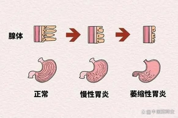 能再詳細分析幾個拒食原因嗎，厭深入探討拒食現象 能再詳細分析幾個拒食原因嗎，厭深入探討拒食現象 龍魚百科 第11張
