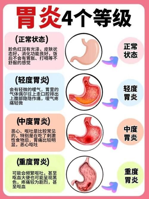 能再詳細分析幾個拒食原因嗎，厭深入探討拒食現象 能再詳細分析幾個拒食原因嗎，厭深入探討拒食現象 龍魚百科 第10張