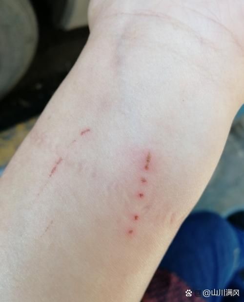 被龍魚咬傷后需要多久恢復(fù)，被龍魚咬傷后多久可以洗澡