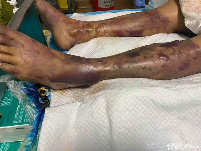 如何判斷海水魚是否受到細(xì)菌感染，如何判斷海水魚是否受到細(xì)菌感染——專業(yè)診斷全流程詳解