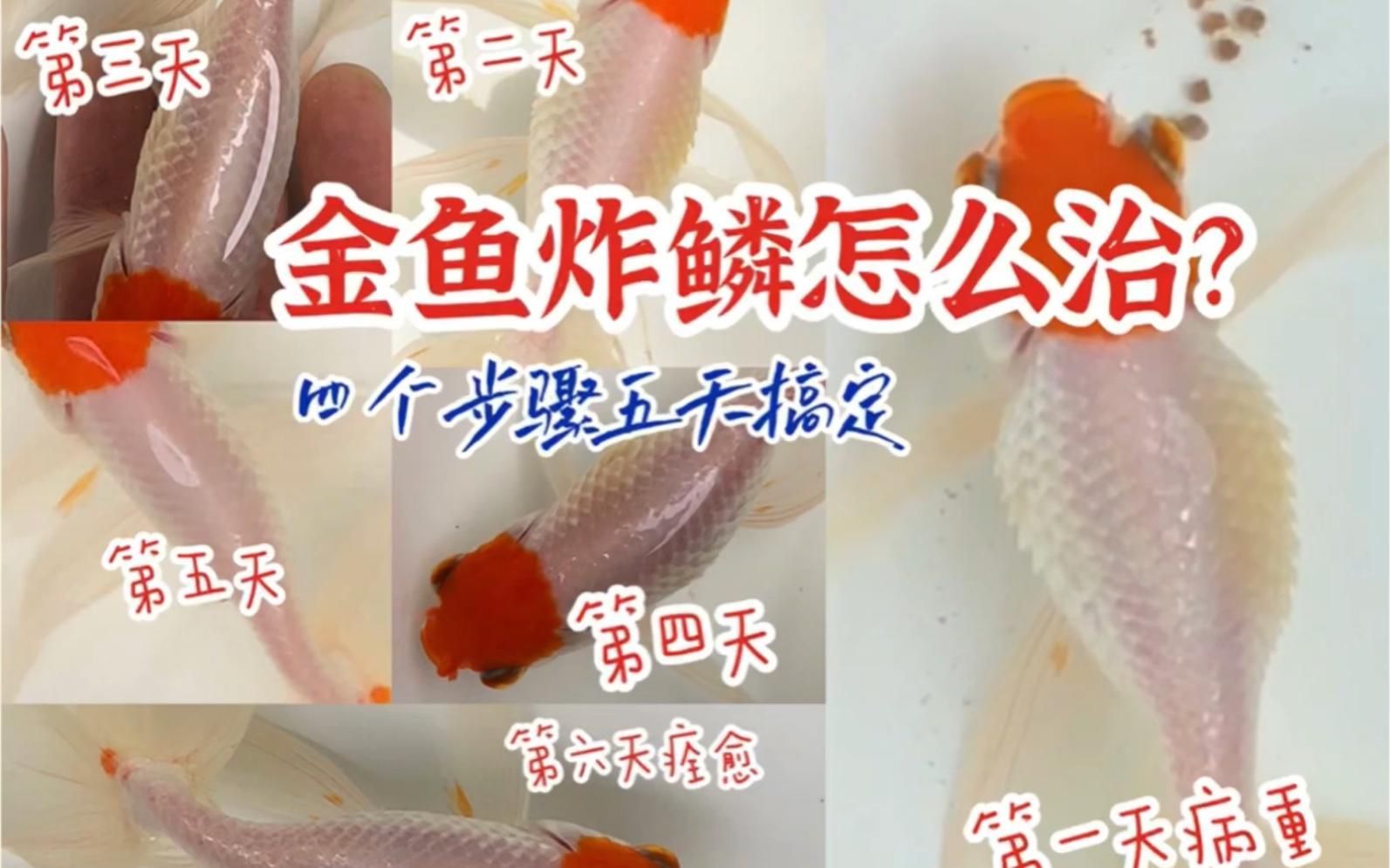 有哪些藥物可以有效治療炸鱗，\