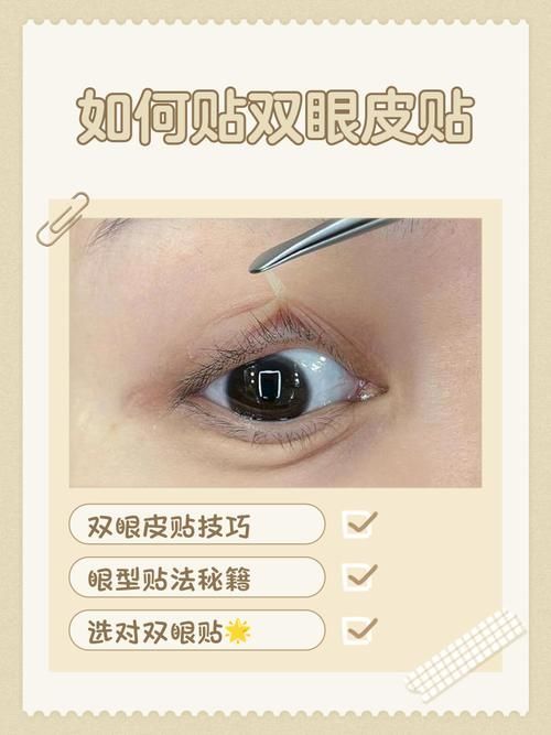 如何預防蒙眼病復發，眼病復發的預防措施