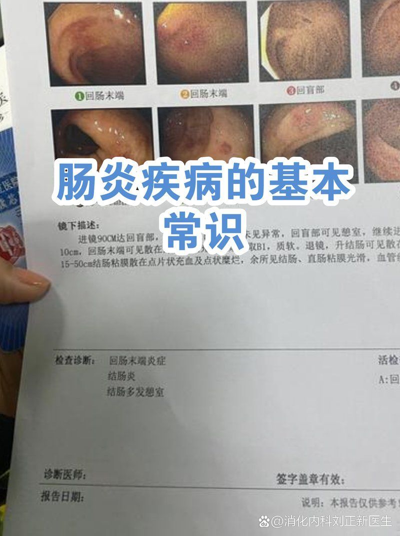 如何區分內寄和腸炎，內寄和腸炎哪個更嚴重