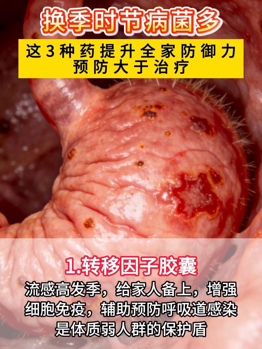 哪些藥物是預防性使用的，性使用的藥物通常是指哪些情況下需要預防性使用的藥物
