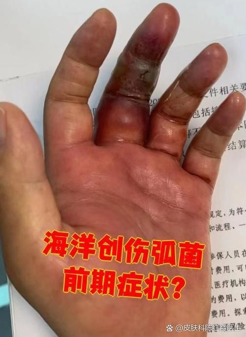 有哪些預防海里細菌感染的方法，富媒體組件預防海里細菌感染 有哪些預防海里細菌感染的方法，富媒體組件預防海里細菌感染 龍魚百科 第5張