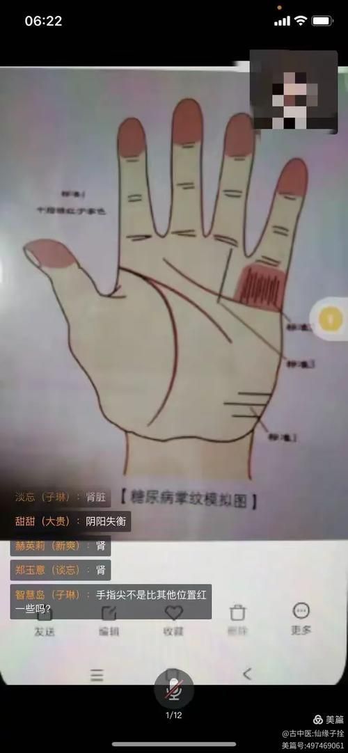如何判斷自己是否患有這三種病，如何判斷自己是否患有“這三種病”